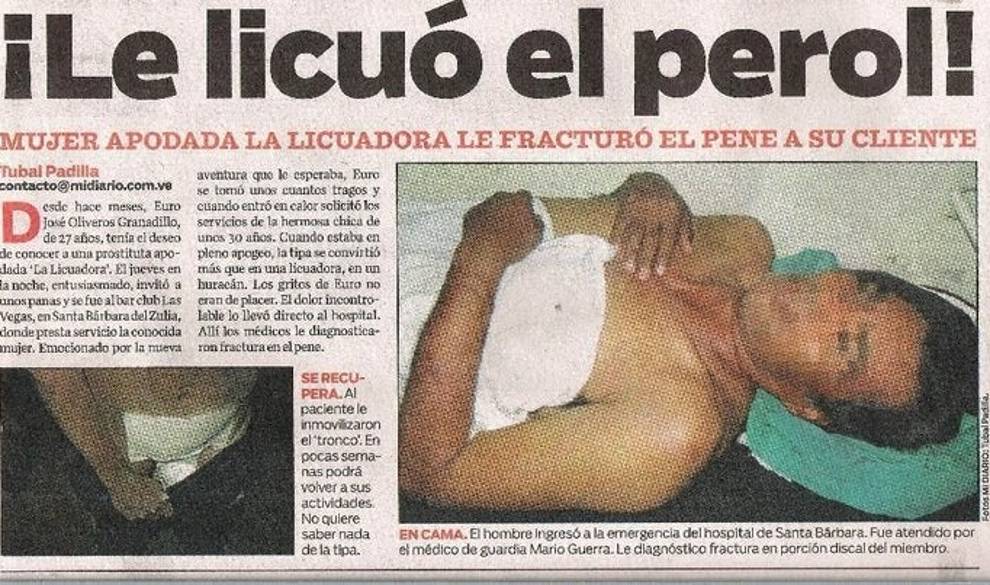 Estas son las formas en las que se puede romper un pene $!Estas son las formas en las que se puede romper un pene