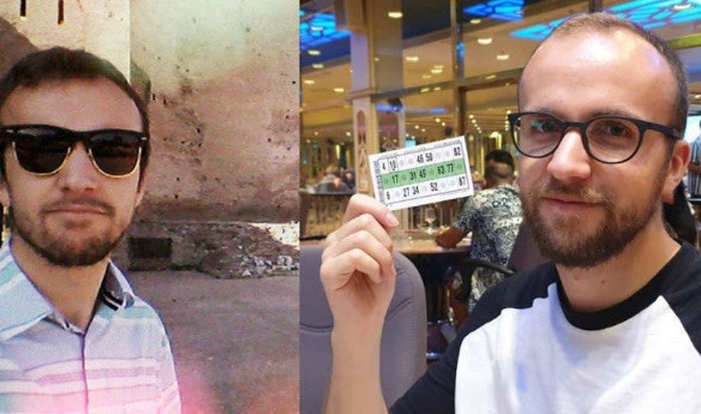 Tengo 25 años y acabo de asumir que soy calvo $!Tengo 25 años y acabo de asumir que soy calvo