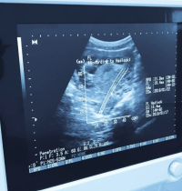 El latido fetal, la estrategia de Vox contra el aborto