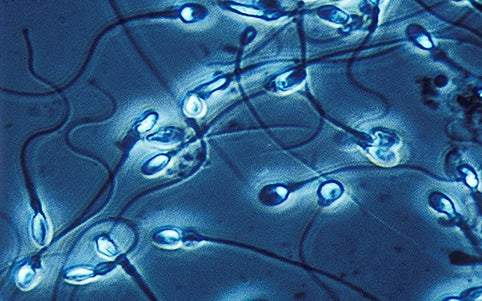 La contaminación del aire de tu ciudad podría estar debilitando tus espermatozoides $!La contaminación del aire de tu ciudad podría estar debilitando tus espermatozoides