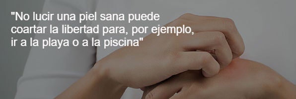 psoriasis-mileniales-codigo-nuevo $!psoriasis-mileniales-codigo-nuevo