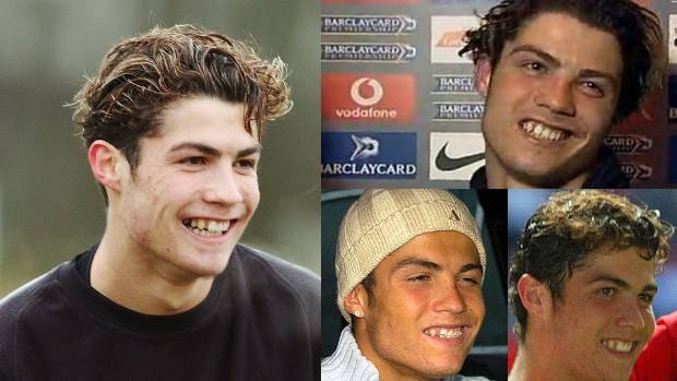 8 Deportistas Que Desearían Poder Quemar Sus Fotos De La Adolescencia $!8 Deportistas Que Desearían Poder Quemar Sus Fotos De La Adolescencia