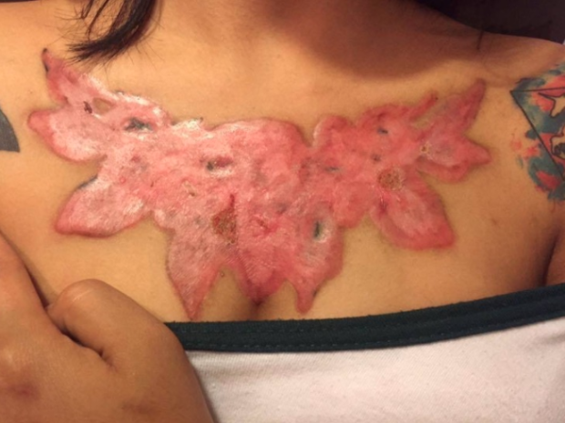 Estos son los riesgos que hacerte un tatuaje puede tener para tu salud $!Estos son los riesgos que hacerte un tatuaje puede tener para tu salud