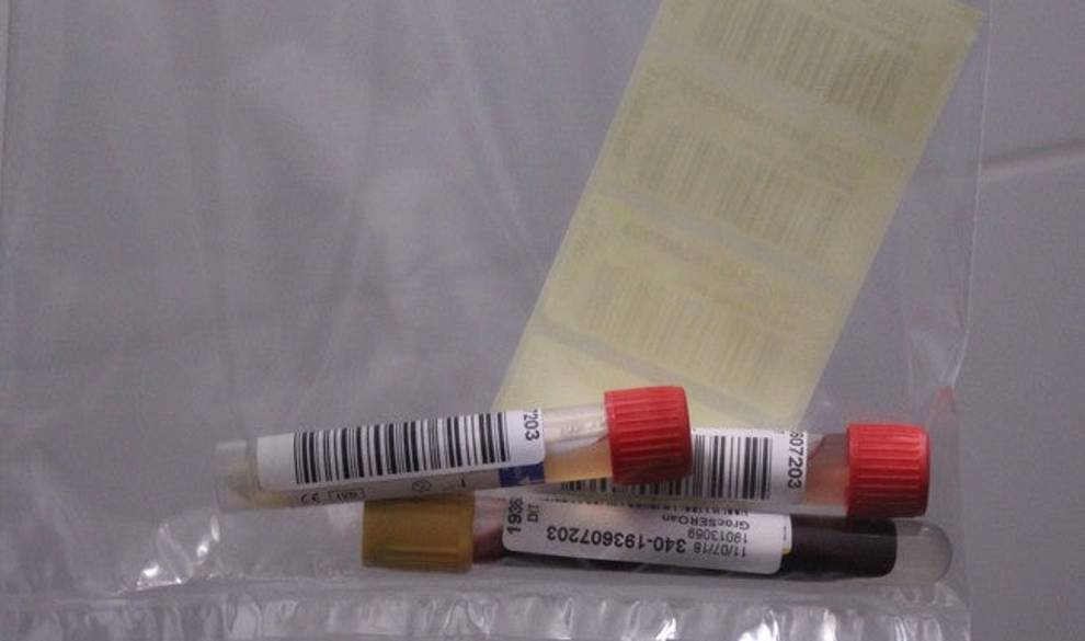 Prueba express de ITS: Así de fácil fue comprobar mi salud sexual $!Prueba express de ITS: Así de fácil fue comprobar mi salud sexual