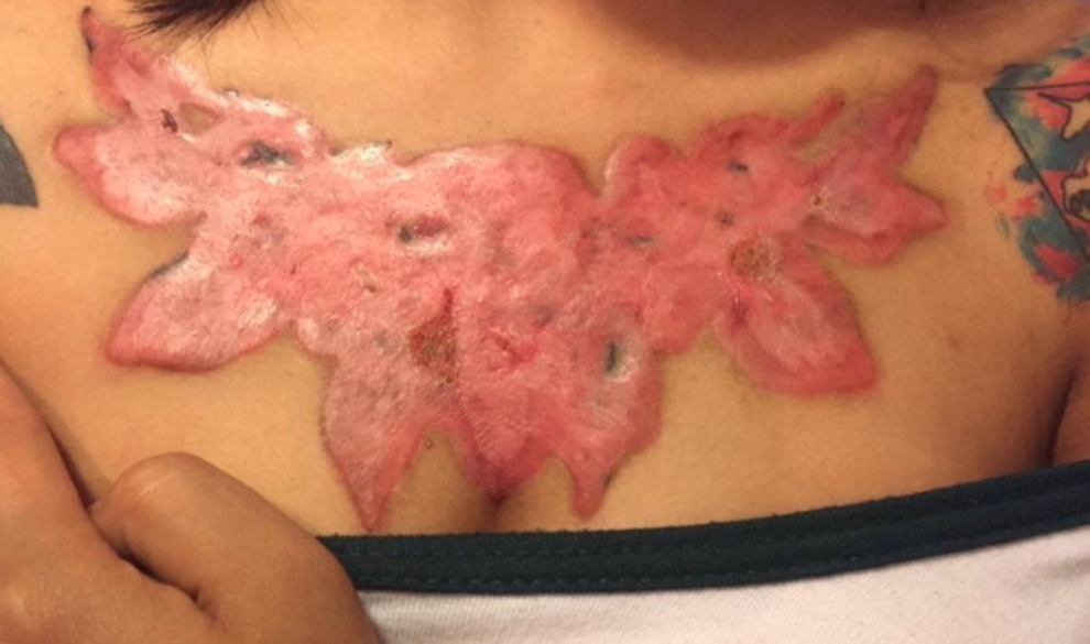 Estos son los riesgos que hacerte un tatuaje puede tener para tu salud $!Estos son los riesgos que hacerte un tatuaje puede tener para tu salud