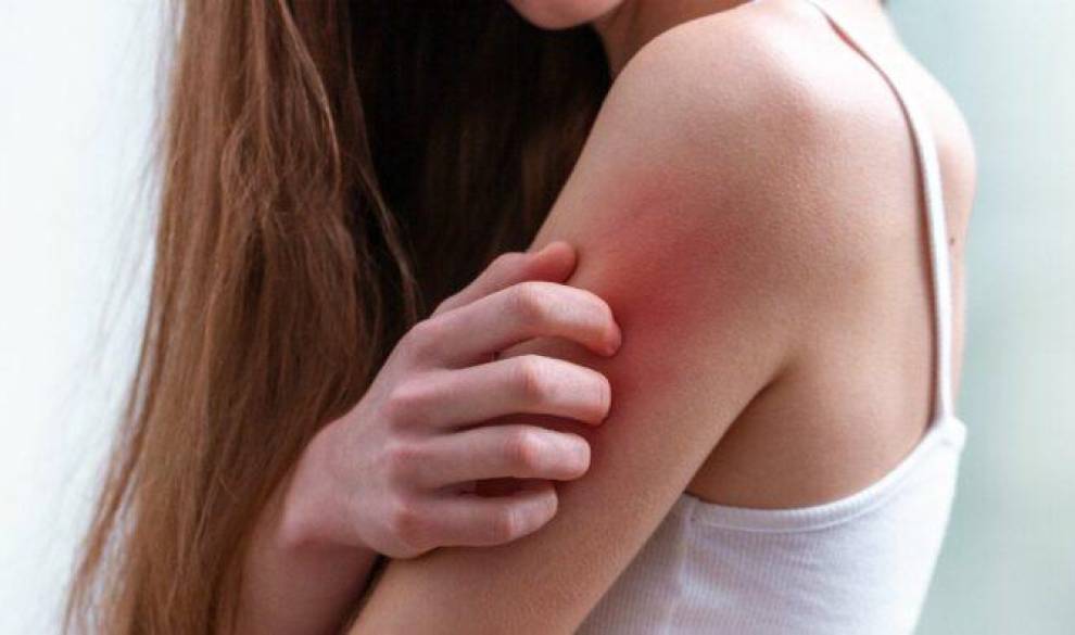 Cómo es convivir con la dermatilomanía, el trastorno por el que te dañas la piel