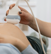 Parir en un hospital privado aumenta un 52% la probabilidad de cesárea