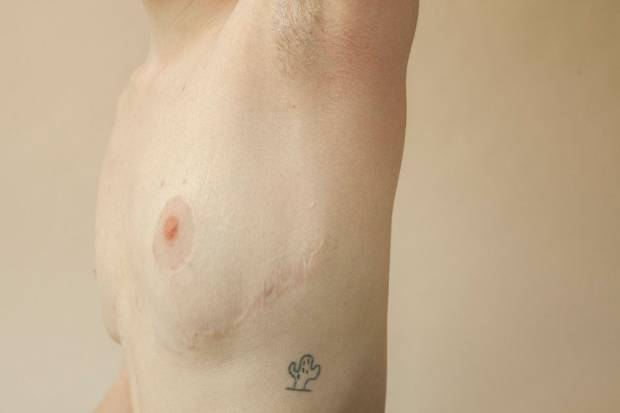 $!Sophie Mayanne, la fotógrafa que captura las cicatrices como preciosas heridas de vida