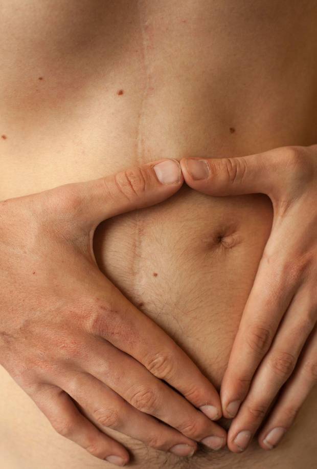$!Sophie Mayanne, la fotógrafa que captura las cicatrices como preciosas heridas de vida