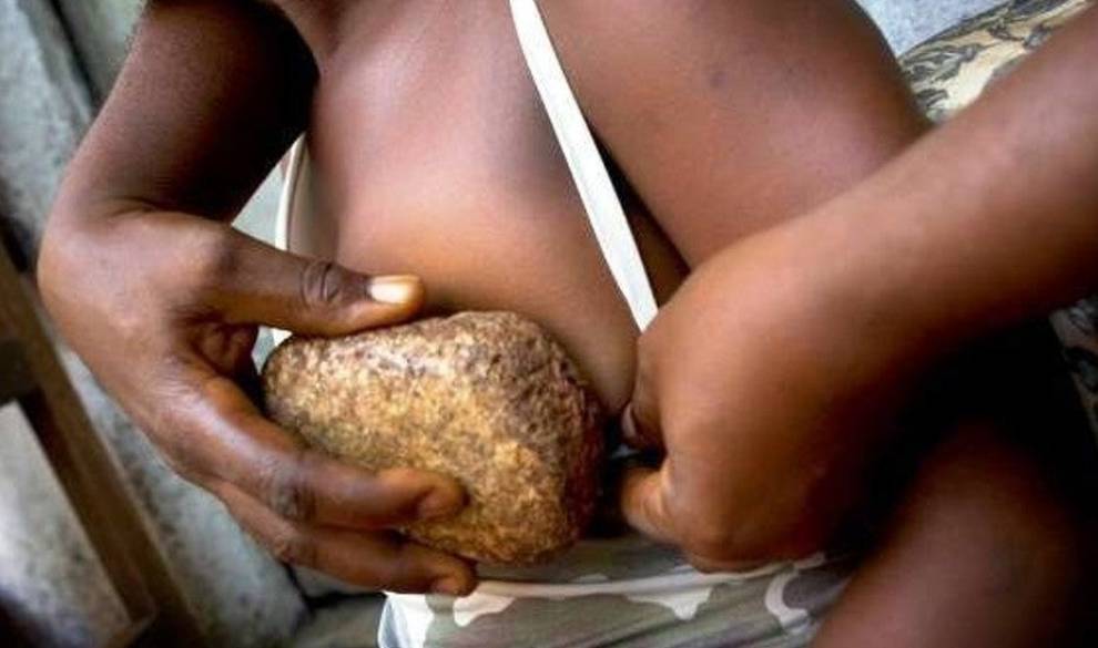 El planchado de senos, la tortura femenina invisibilizada que sufren millones de adolescentes