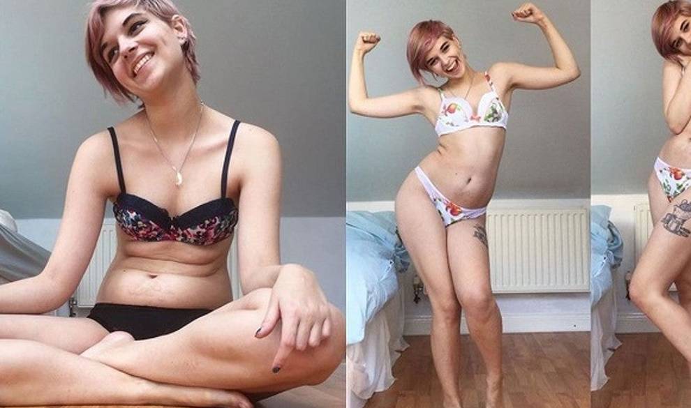 Una instagramer documenta cómo va superando la anorexia para inspirar al mundo
