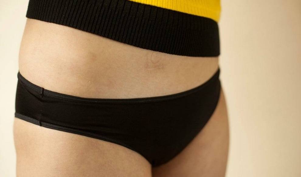 Sophie Mayanne, la fotógrafa que captura las cicatrices como preciosas heridas de vida