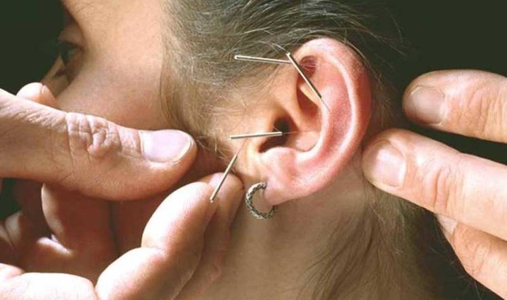 Curar a través de las orejas: ¿técnica milenaria o efecto placebo?