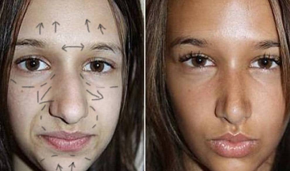Cirugía estética a los 14: los menores que quieren pasar por quirófano