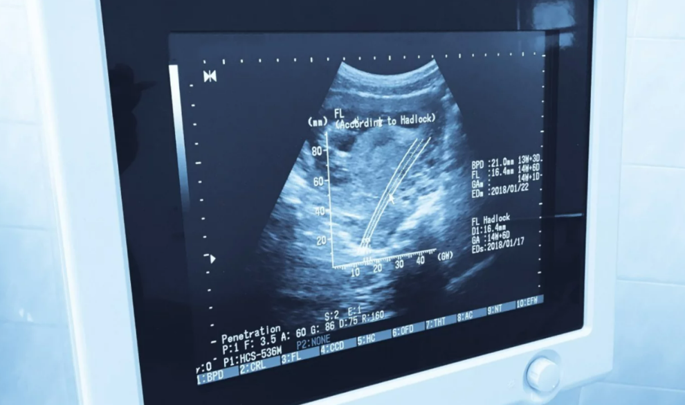 El latido fetal, la estrategia de Vox contra el aborto